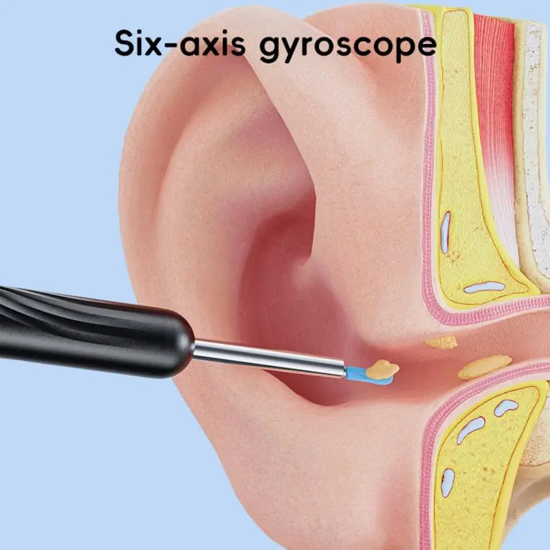 Smart Visual Ear Cleaner Camera