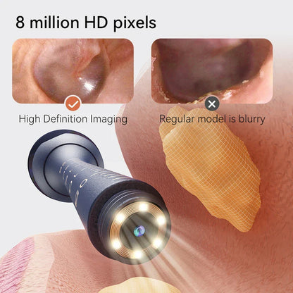Smart Visual Ear Cleaner Kit